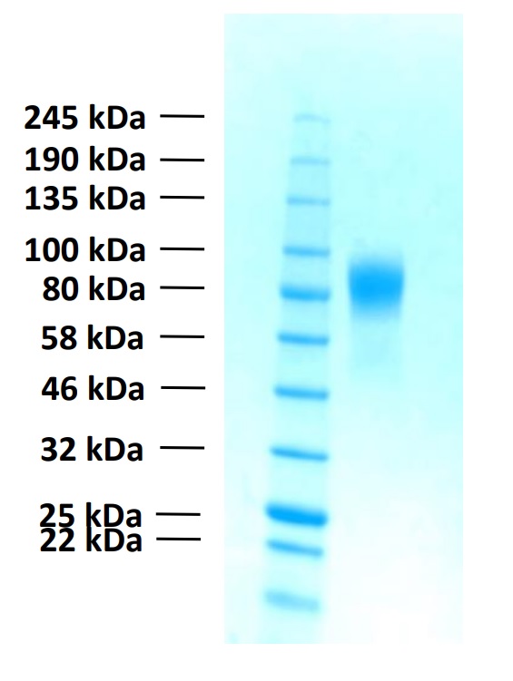 Recombinant Human FGFR1b Protein (Functional)