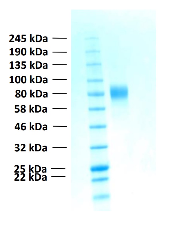 Recombinant Human FGFR2b Protein (Functional)