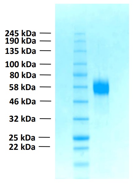 Recombinant Human FGFR4 Protein (Functional)