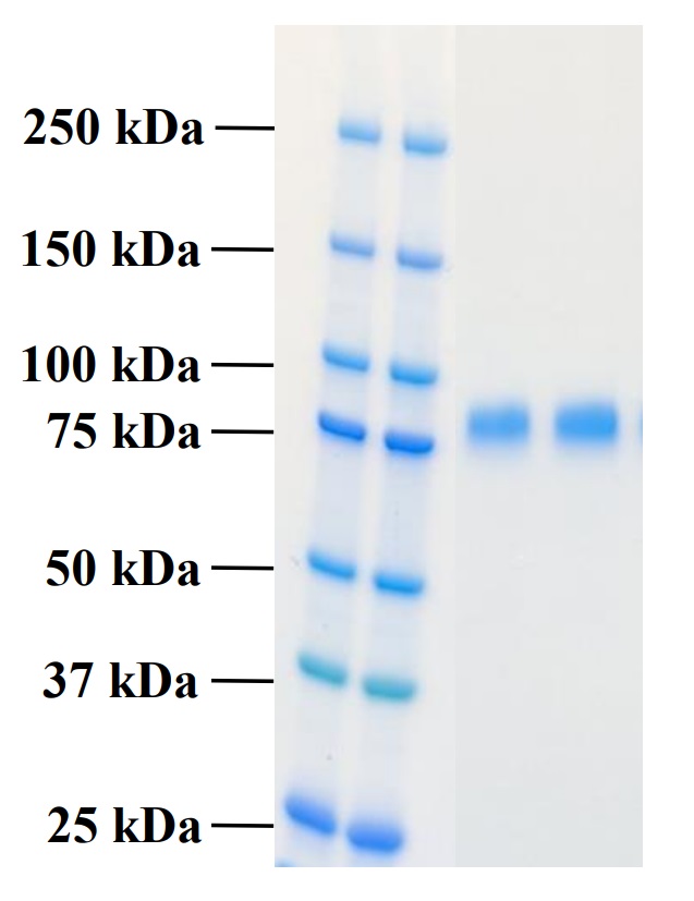 Recombinant Human PLA2R1 Protein (Functional)