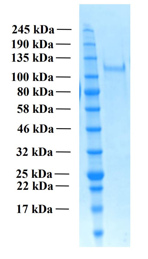 Recombinant Human THSD7A Protein (Functional)