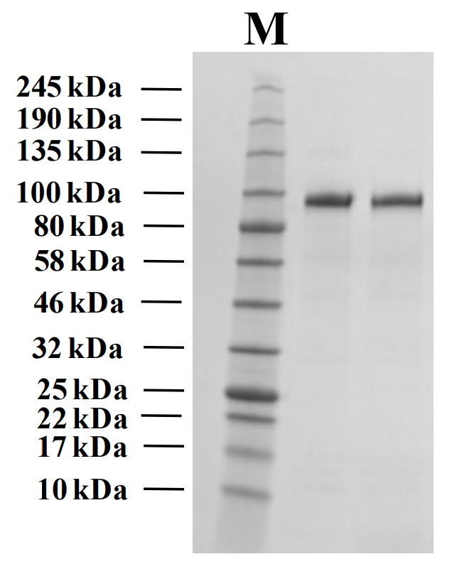 Recombinant Human Autotaxin Protein (Functional)