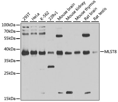 Anti-G protein beta subunit like / GBL Antibody