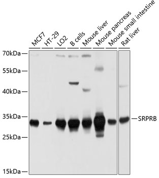 Anti-SRPRB Antibody