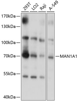 Anti-alpha 1,2 Mannosidase IA / MAN1A1 Antibody