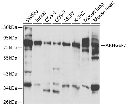 Anti-ARHGEF7 Antibody