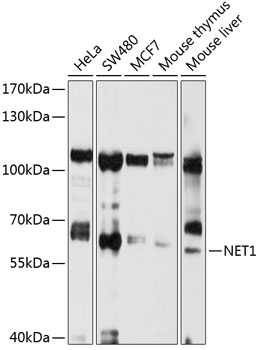 Anti-NET1 Antibody