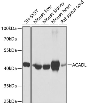 Anti-ACADL / LCAD Antibody