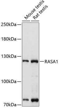 Anti-RASA1 Antibody