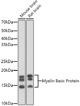 Anti-Myelin Basic Protein Antibody