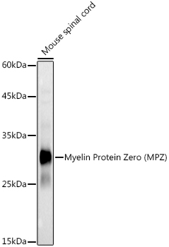 Anti-Myelin Protein Zero Antibody