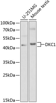 Anti-DKC1 / Dyskerin Antibody