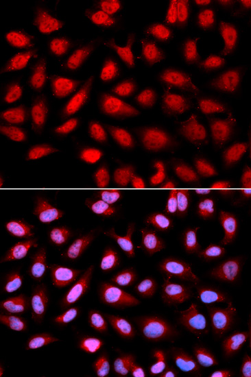 Anti-PPP2R4 Antibody - Identical to Abcam (ab186866)