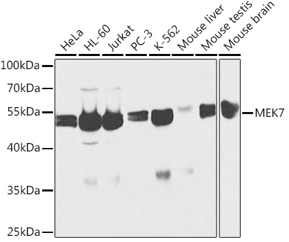 Anti-MKK7 Antibody