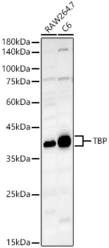 Anti-TATA binding protein TBP Antibody