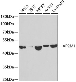 Anti-AP2M1 Antibody