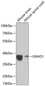 Anti-GNAO1 Antibody