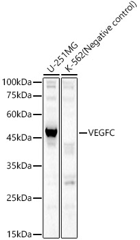 Anti-VEGFC Antibody