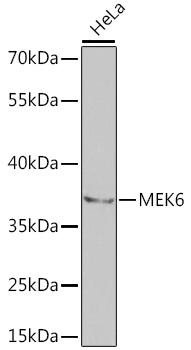 Anti-MKK6 Antibody