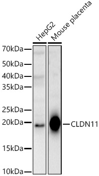 Anti-Oligodendrocyte Specific Protein Antibody