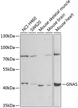 Anti-GNAS Antibody
