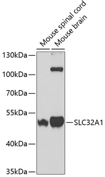 Anti-SLC32A1 / VGAT Antibody