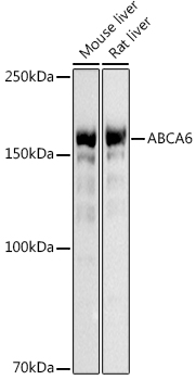 Anti-ABCA6 Antibody