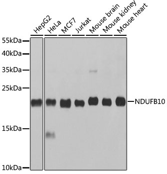 Anti-NDUFB10 Antibody