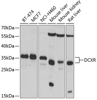Anti-DCXR Antibody