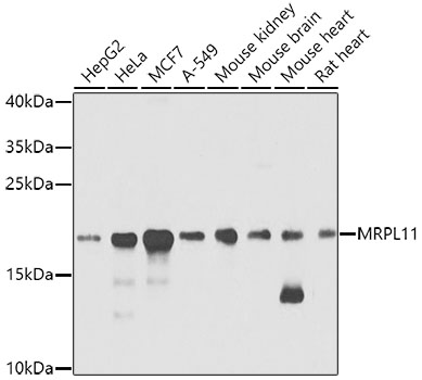 Anti-Mitochondrial ribosomal protein L11 Antibody