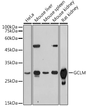 Anti-GCLM Antibody