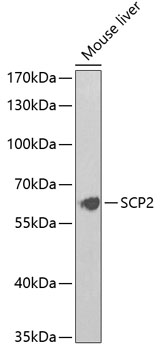 Anti-Sterol carrier protein 2 Antibody