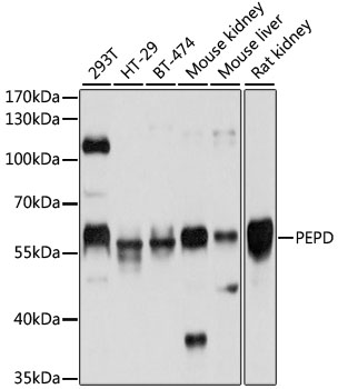 Anti-PRD Antibody - Identical to Abcam (ab186851)