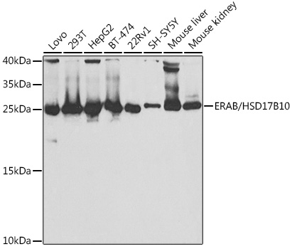 Anti-ERAB Antibody - Identical to Abcam (ab186853)