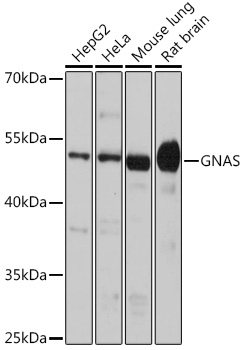 Anti-GNAS Antibody