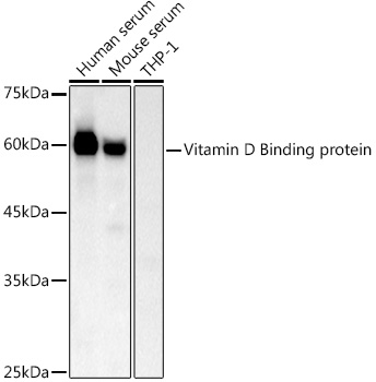 Anti-Vitamin D Binding protein Antibody