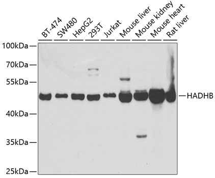 Anti-HADHB Antibody