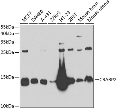 Anti-CRABP2 Antibody