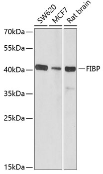Anti-FIBP Antibody