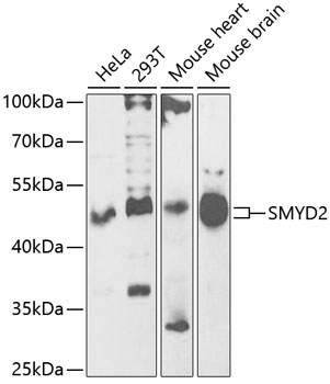 Anti-KMT3C / SMYD2 Antibody