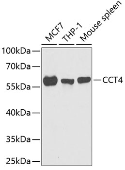 Anti-TCP1 delta Antibody