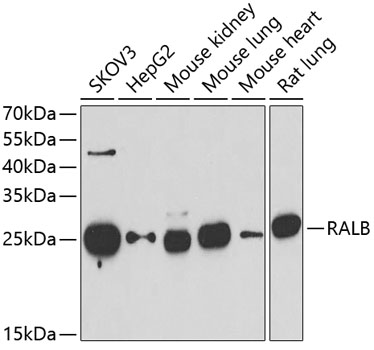 Anti-RALB Antibody