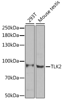 Anti-TLK2 Antibody