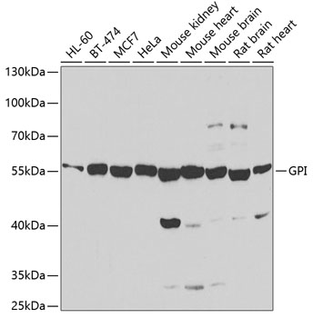 Anti-GPI Antibody