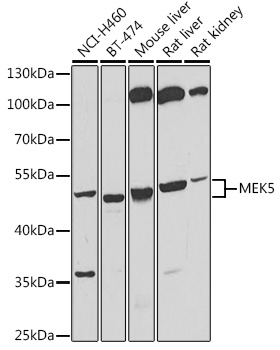 Anti-MEK5 Antibody - Identical to Abcam (ab210748)