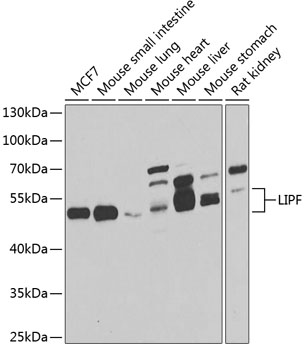 Anti-LIPF Antibody