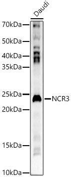Anti-NKp30 Antibody