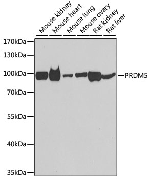 Anti-PRDM5 Antibody