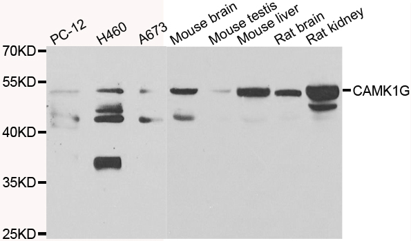 Anti-CAMK1G Antibody