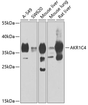 Anti-AKR1C4 Antibody